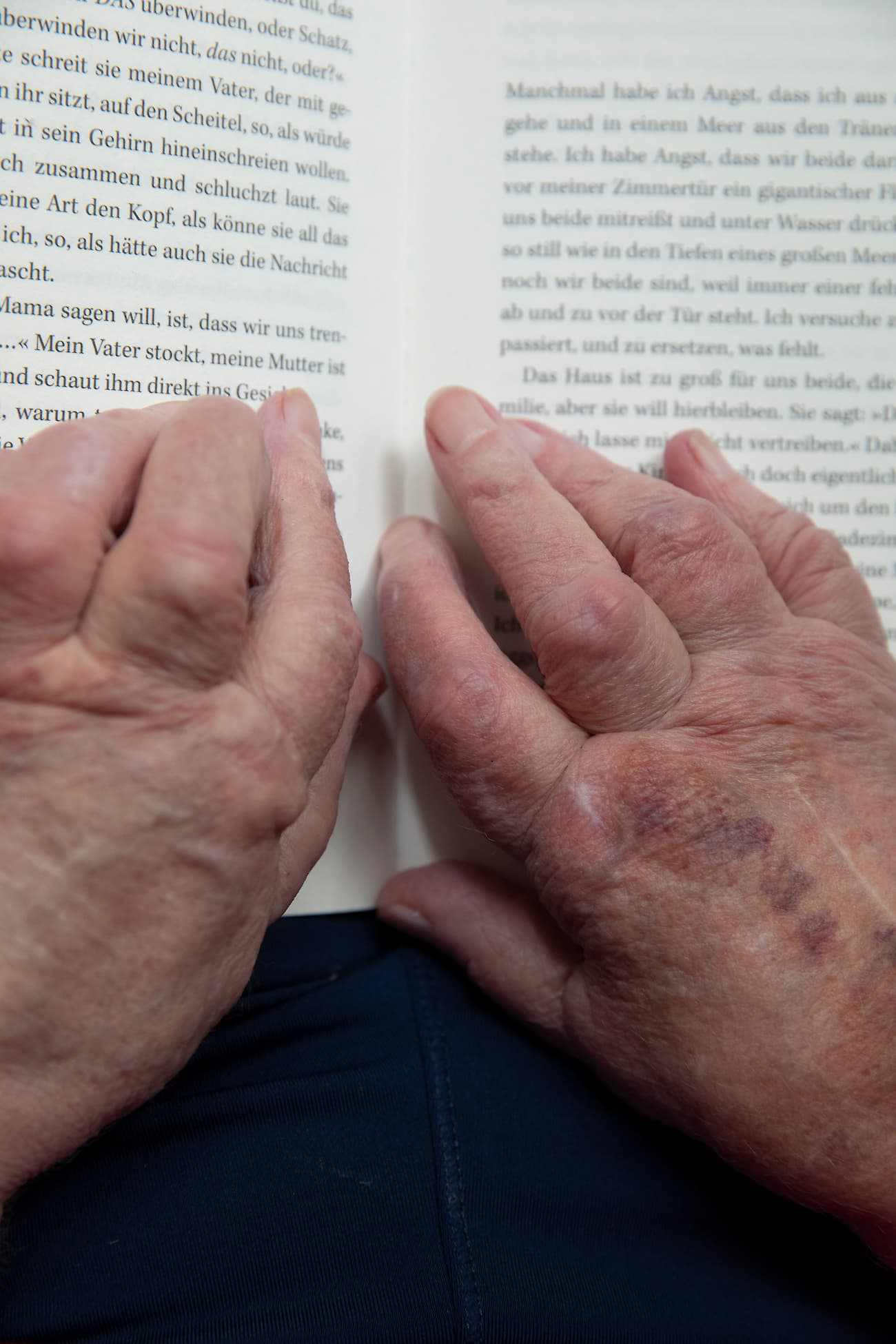 Rheumatoide Arthritis (AOK Magazin, Assignment Reportage 2019) - Matthias Ferdinand Döring